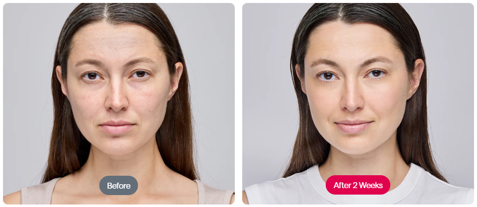 ReGlow - LED Light Therapy Mask