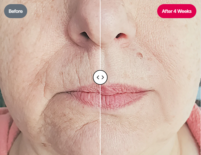 ReGlow - LED Light Therapy Mask